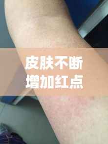 皮肤不断增加红点,皮肤上红点点越来越多怎么办