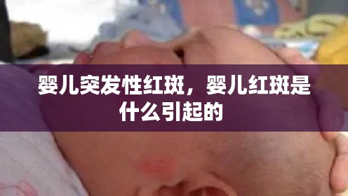 婴儿突发性红斑，婴儿红斑是什么引起的 
