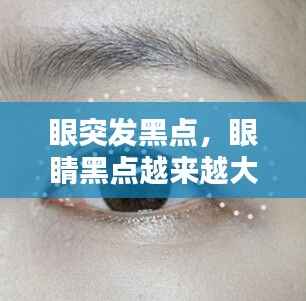 眼突发黑点,眼睛黑点越来越大